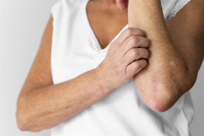 Srbeča koža brez izpuščajev ima lahko več različnih vzrokov. (Foto: Freepik)