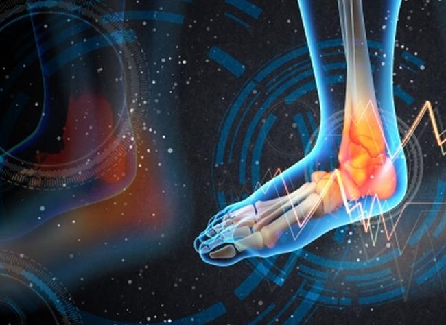 Kalcij, vitamin D in gibanje preprečujejo osteoporozo. (foto: FreeDigitalPhotos.net)