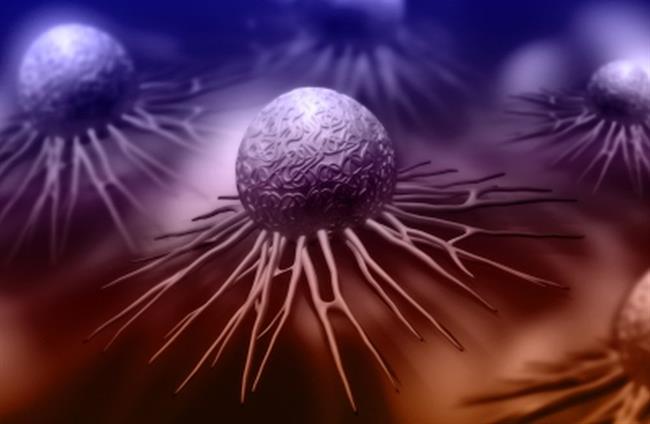 Rak prostate je najpogostejši rak med moškimi.  (foto: FreeDigitalPhotos.net)