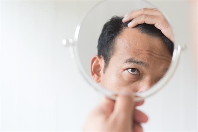V nekaterih primerih se je pokazalo, da je lahko čebulna voda tudi učinkovito zdravilo proti izpadanju las, saj stimulira lasišče in krvni pretok, kar vpliva na delovanje lasnih mešičkov. (FOTO: Freepik.com)