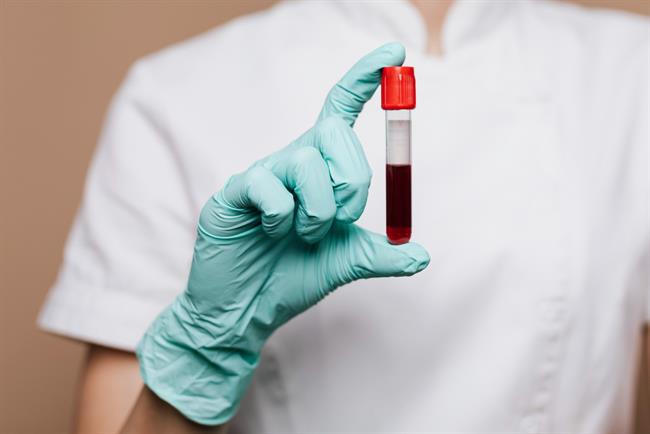 	Kri krvne skupine 0 vsebuje manj molekul, ki lahko izzovejo zgoščevanje krvi, pa tudi srčno in možgansko kap. (Foto: Freepik.com)
