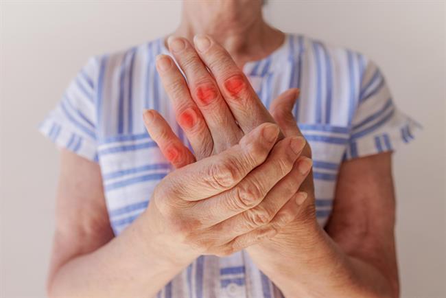 Osteoartritis je najpogostejša vrsta artritisa, ki zmanjša kakovost življenje številnih starostnikov. (foto: Freepik.com)