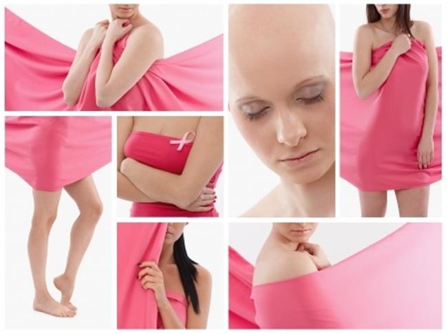 Rak dojk je najpogostejša oblika raka pri ženskah tudi pri nas. (foto: www.123rf.com)