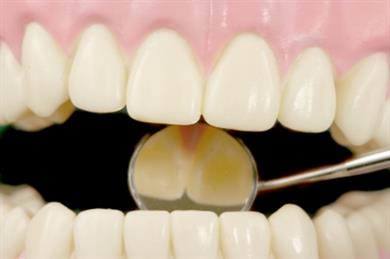 Enostaven trik za bolj bele zobe