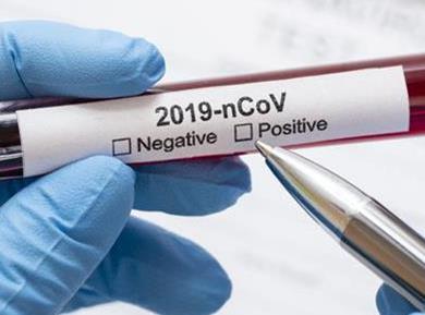 Začela se je raziskava koronavirusa v Sloveniji